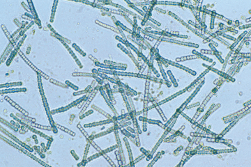 CSIRO_ScienceImage_4203_A_bluegreen_algae_species_Cylindrospermum_sp_under_magnification.jpg